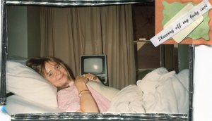 Body cast at 17 years.